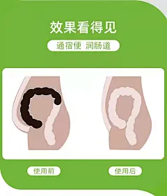 大今美穴位压力刺激贴 通便贴肚脐贴 中草药萃取源头厂家-搜采通
