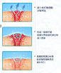 倍舒痕儿童宝宝去疤膏修复小孩脸部专用疤痕dermatix硅酮祛疤凝胶-tmall.hk天猫国际