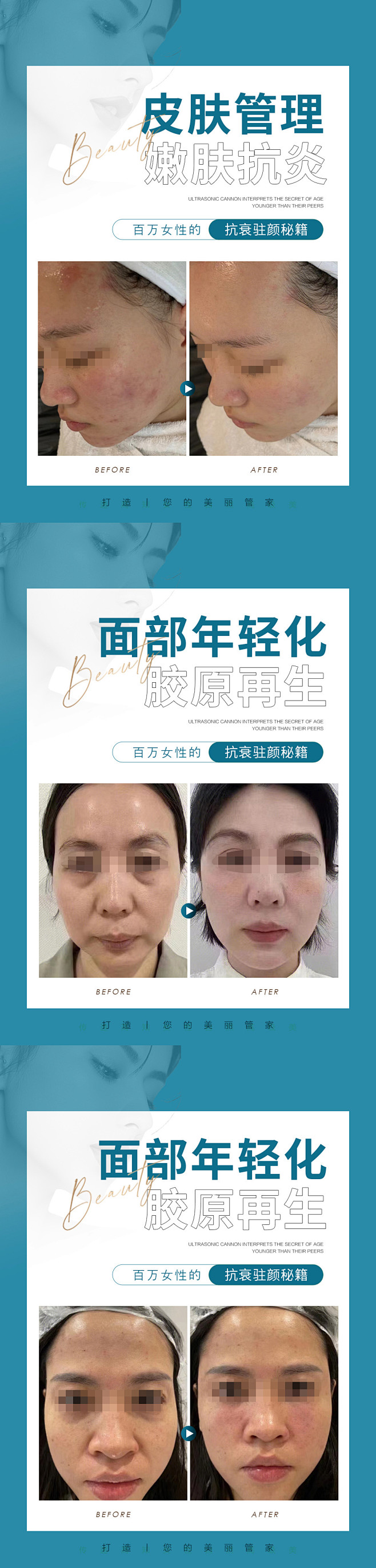 医美案例对比模板