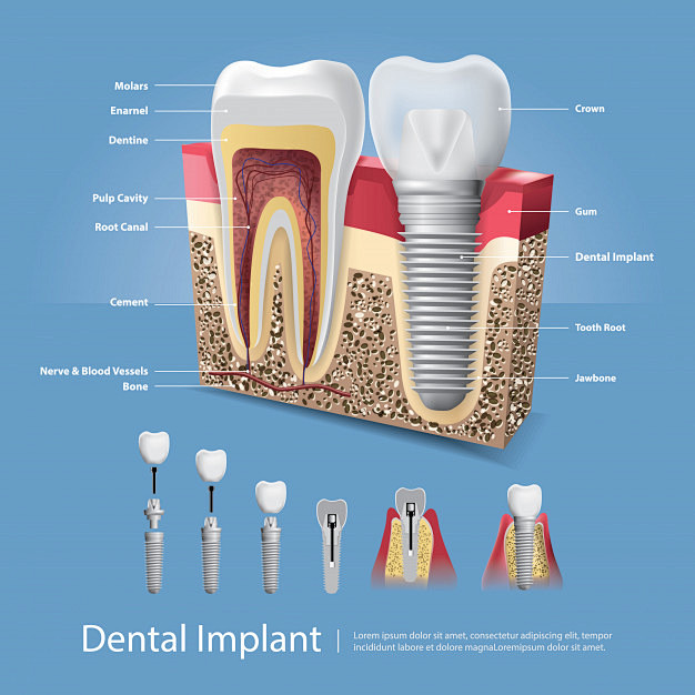 Human teeth and dent...