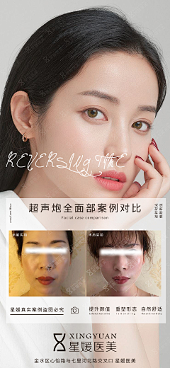 娜DADA采集到案例对比