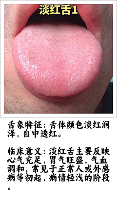 阿宅学医记采集到舌诊图