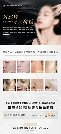 医美轻医美美业外泌体水光种植简约海报-设计素材-shejisc.cn