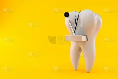 用牙科工具拔牙