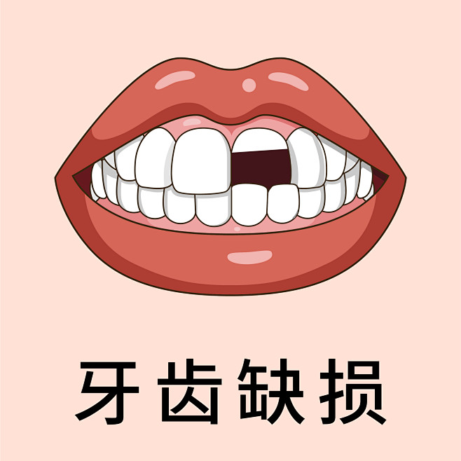 医美 口腔 牙齿 牙齿类型 牙齿缺损 缺...