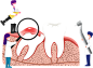 【拔牙】乳牙拔出_0002_摄图网_401917909_智齿萌出（非企业商用）