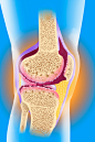 健康保健,影棚拍摄,四肢,腿,生病_149321512_Knee Osteoarthritis, Drawing_创意图片_Getty Images China