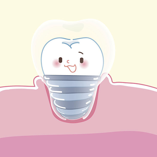 可爱的卡通牙种植体矢量图素材