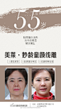 青春其实很短暂
#美莱·妙龄童颜线雕#
定格妙龄容颜
塑造青春线雕
6月福利持续放送中