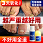 灰指甲专用治療顽固增厚型灰甲净日本冰醋酸杀菌抑菌液外用正品藥-tmall.com天猫
