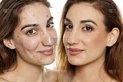 美容治疗前后同一妇女的比较肖像白色背景化妆