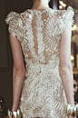 Lace Detail Dress