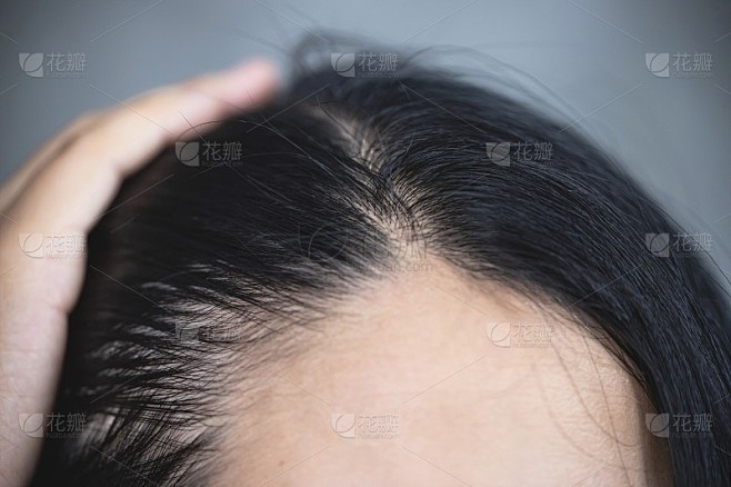 年轻女子露出她灰白的发根