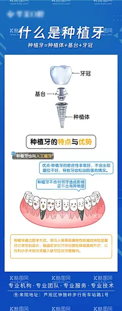 什么是种植牙海报  - 源文件下载【酷图网】海报,口腔,什么是种植牙,科普,质感,创意,