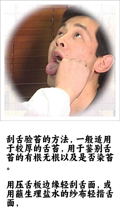阿宅学医记采集到舌诊图