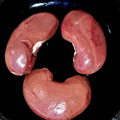 肾脏照片下载