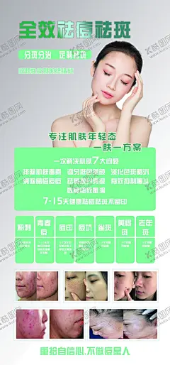 祛痘祛斑 【酷图网】祛痘祛斑,祛痘祛斑展架,祛痘,祛斑,祛痘对比图,祛痘祛斑海报
