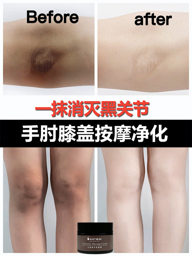 去黑色素沉淀脸部全身嘴唇乳晕缩小腋下脖子...