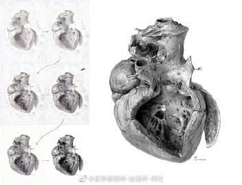 Max Brödel 心脏绘制的研究  ...