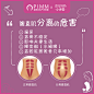 产后恢复 产后修复 腹直肌