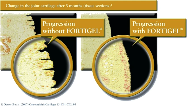 Fortigel-花瓣网