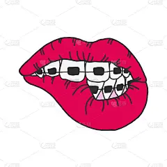 Sexy lips and teeth in bright color braces