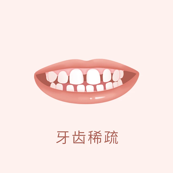 牙齿 口腔 漫画 插画 卡通 牙齿矫正 牙齿疾病 牙齿稀疏 牙齿错乱 反颌 牙列拥挤 中线不齐 开颌 牙齿缺损 深覆合 龅牙 牙齿不齐 偏颌 