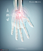 手部骨骼健康诊疗透视影片医疗海报 海报招贴 医疗药品