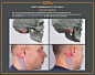 Mastoid process.jpg