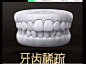 牙齿稀疏
