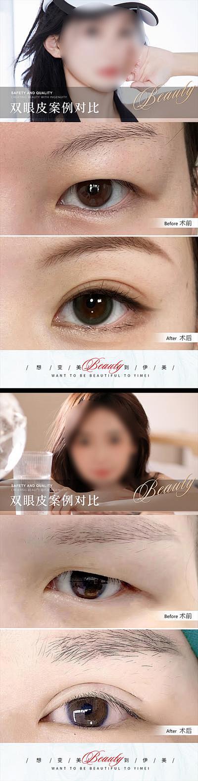 【南门网】广告 海报 医美 案例 整形 ...