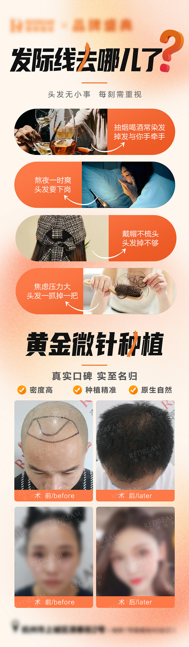 植发简约案例海报-源文件