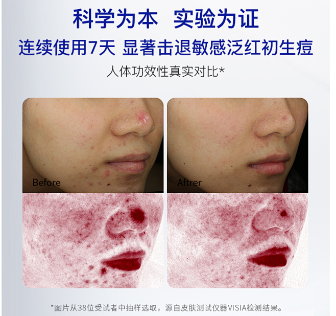 安肤特护修红小鲜乳修护复角质层敏感肌泛红...