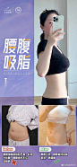 @美莱妍学社 的个人主页 - 微博