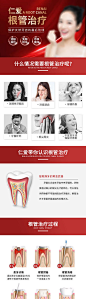 根管治疗-源文件