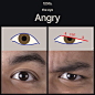 Anger (the eye)