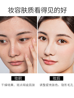 *海心*采集到皮肤问题