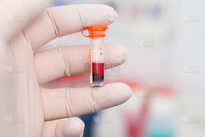 科学家手中的溶血样本