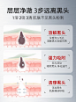 进口清洁泥膜去黑头粉刺闭口收缩毛孔深层补水涂抹式面膜女男专用-tmall.com天猫