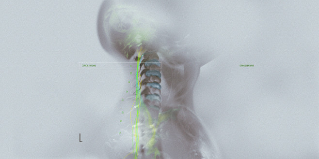 01-A1OU-SKELETAL-DRA...