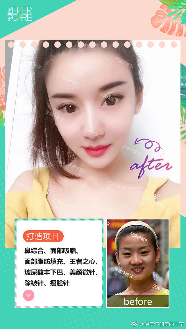 美，从来不是想想而已
原地不动，只会越来...