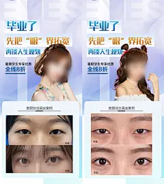 海报  医美  毕业季 暑期  促销  双眼皮     案例  对比 人物