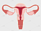 A healthy female reproductive system with the Uter