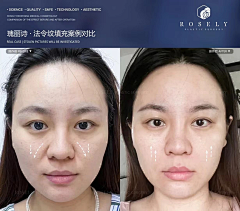 霏girl采集到案例水印