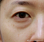 深圳艺星整形医院预约中心的微博_微博
