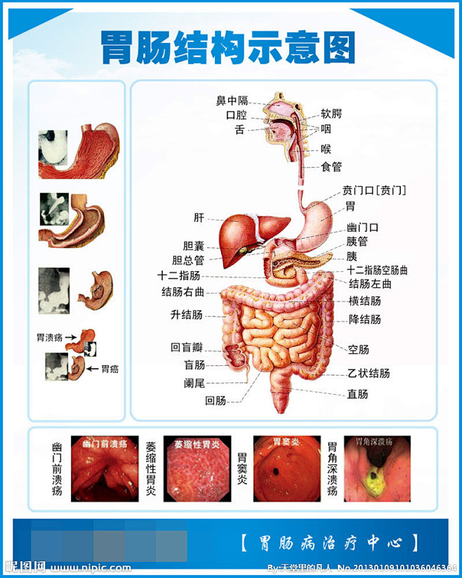 肠部结构示意图 胃 胃肠