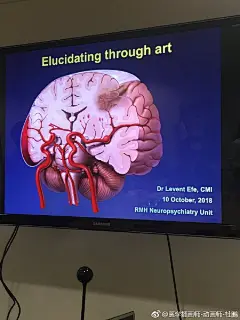 【位图 商业医学插画作品类】用艺术来阐述医学  | 来自资深 CMI 澳洲籍医学插画师 Levent Efe, 感谢这位土耳其人在武汉早好多年前指引我进入医学插画的神圣殿堂  直接影响了我的医学插画风格 
#科学插画# #论文医学插画欣赏# #怎样成为医学插画师# #怎样成为医学动画师#  ​​​​...展开全文c