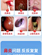 华佗国药鼻炎贴砭贴过敏性鼻炎鼻窦炎鼻塞鼻痒通鼻官方正品礼医生-tmall.com天猫