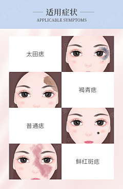 医美插画采集到医美,胎记,痣,斑