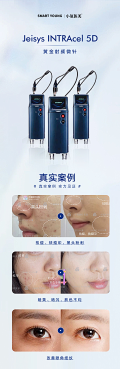 夏末·淺笑采集到小氧 轻医美